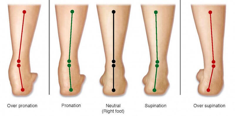 foot orthotics